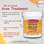 De la Cruz Acne treatment with 10% sulfur 