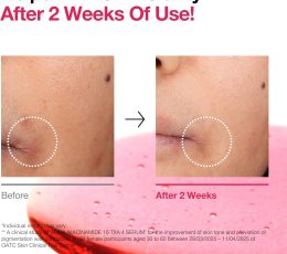 Anua Niacinamide 10% and TXA 4% Dark Spot Correcting Serum 30 ml